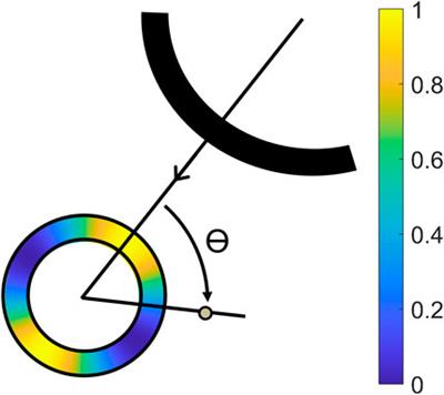 In vivo bistatic dual-aperture ultrasound imaging and elastography of the abdominal aorta